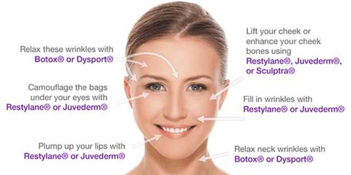 Buy fillers online