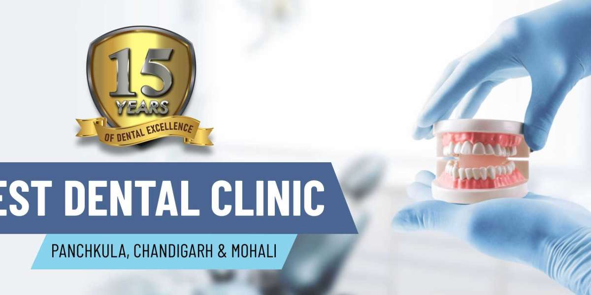 Implant Dentist in Panchkula  -  Dr.Dang