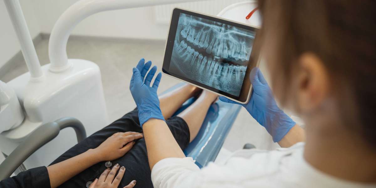 Are Dental Implants Popular?- Reasons To Know!