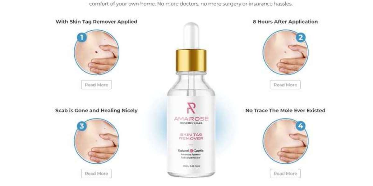 Think You're An Expert In Amarose Skin Tag Remover Reviews? Take This Quiz Now To Find Out!