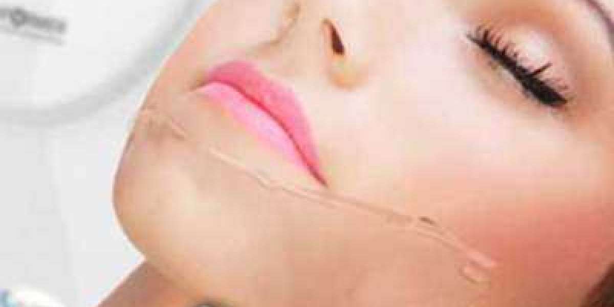 HIFU Skin Tightening Treatment And Its Benefits