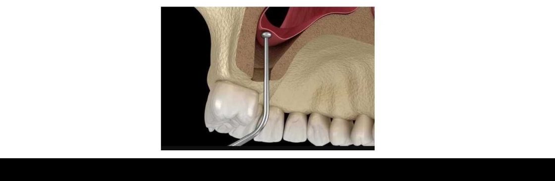 IMPLANT DENTAL CLINIC Cover Image