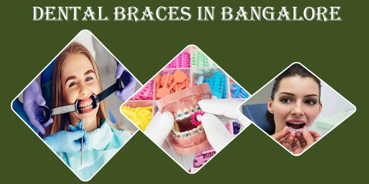 Best Dentist for Braces in Bangalore | Best Dental Clinic