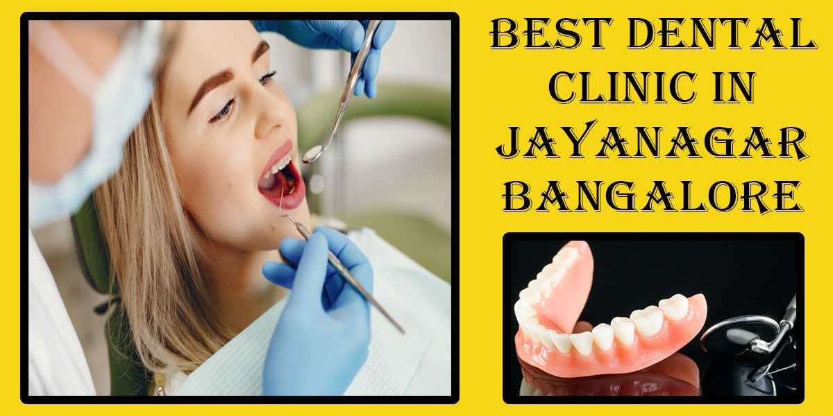 Best Dentist in Jayanagar Bangalore | Famous & Top Dentist