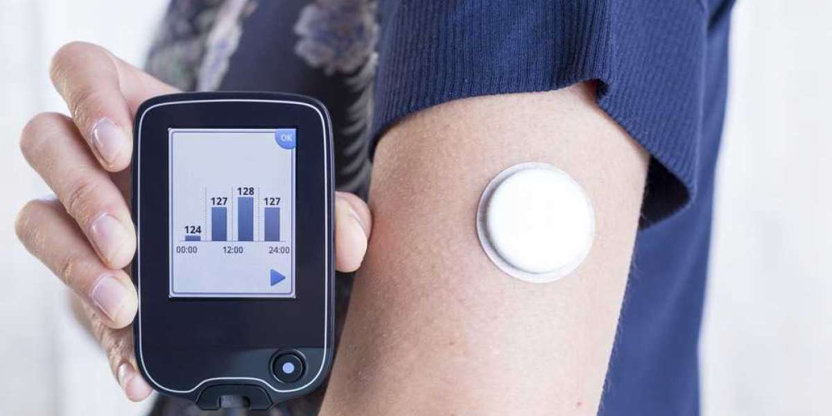 Diabetes Devices Market Size Share, Key players Profiles, Revenue, Regional Analysis and Forecast 2023-2033