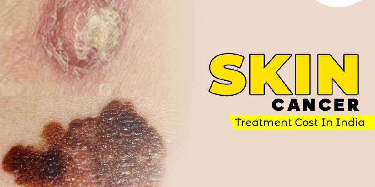 Importance of Early Detection in Skin Cancer Treatment in India