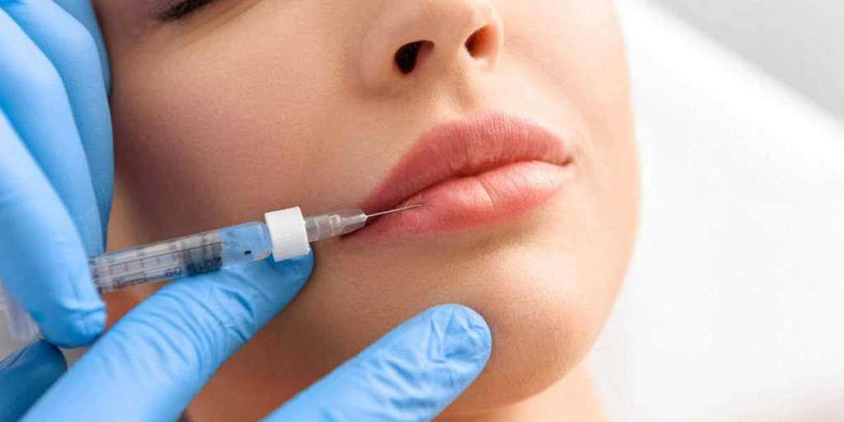 Easy Ways to Figure out Which Dermal Filler is Right for You