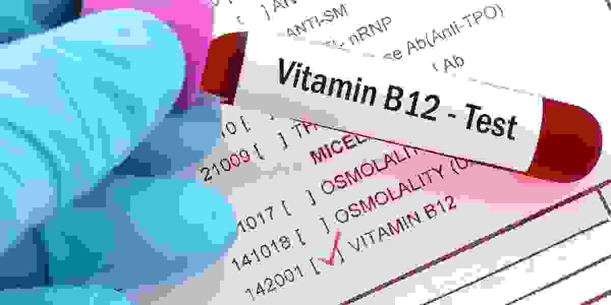 Comprehensive Analysis of Active B12 Test Market with Size and Future Scope