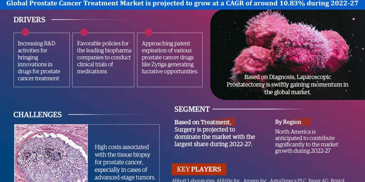 Prostate Cancer Treatment Market Research: Analysis of A Deep Study Forecast 2027 For Growth Trends, Developments