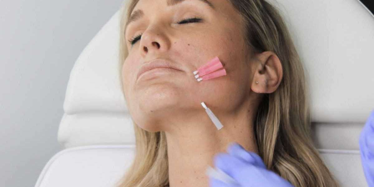 How Long Does a Fractional Laser Resurfacing Treatment Take?