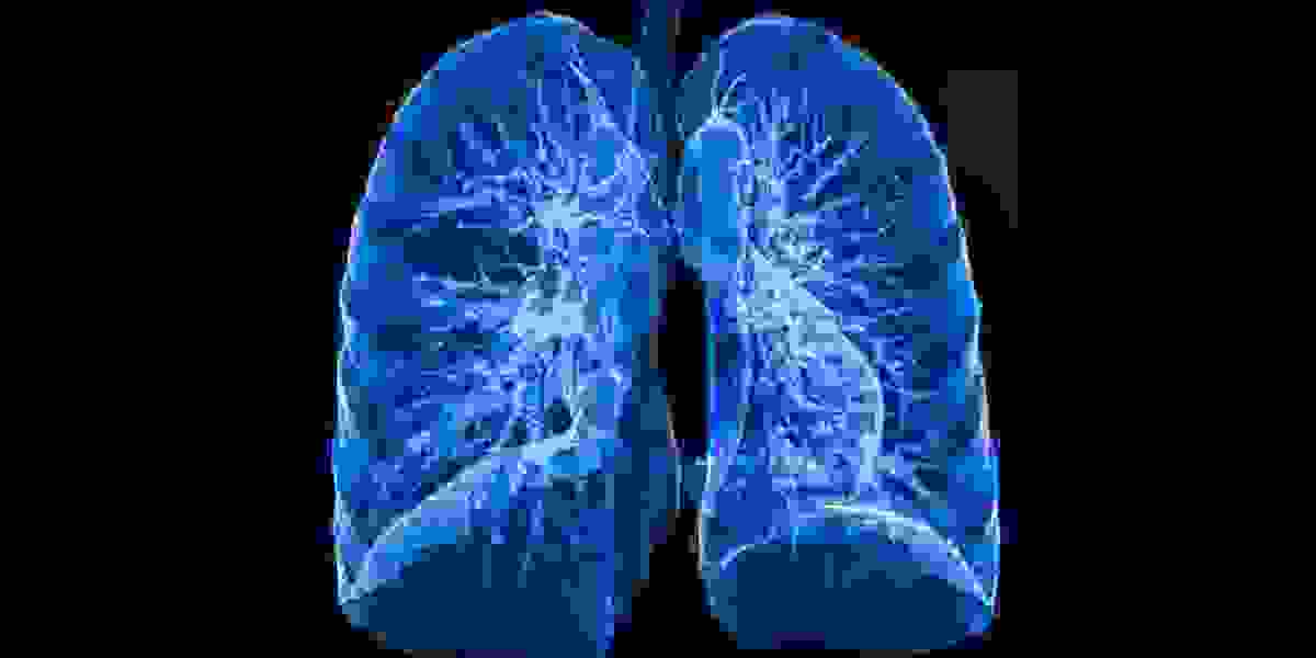 Cystic Fibrosis Market Size 2023 | Forecast till 2033