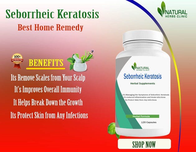 Home Remedies for Seborrheic Keratosis: Effective At-Home Treatment