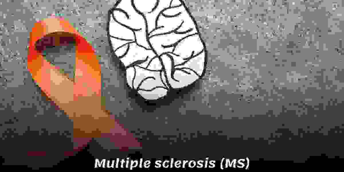 Exploring Ayurvedic Approaches to Multiple Sclerosis