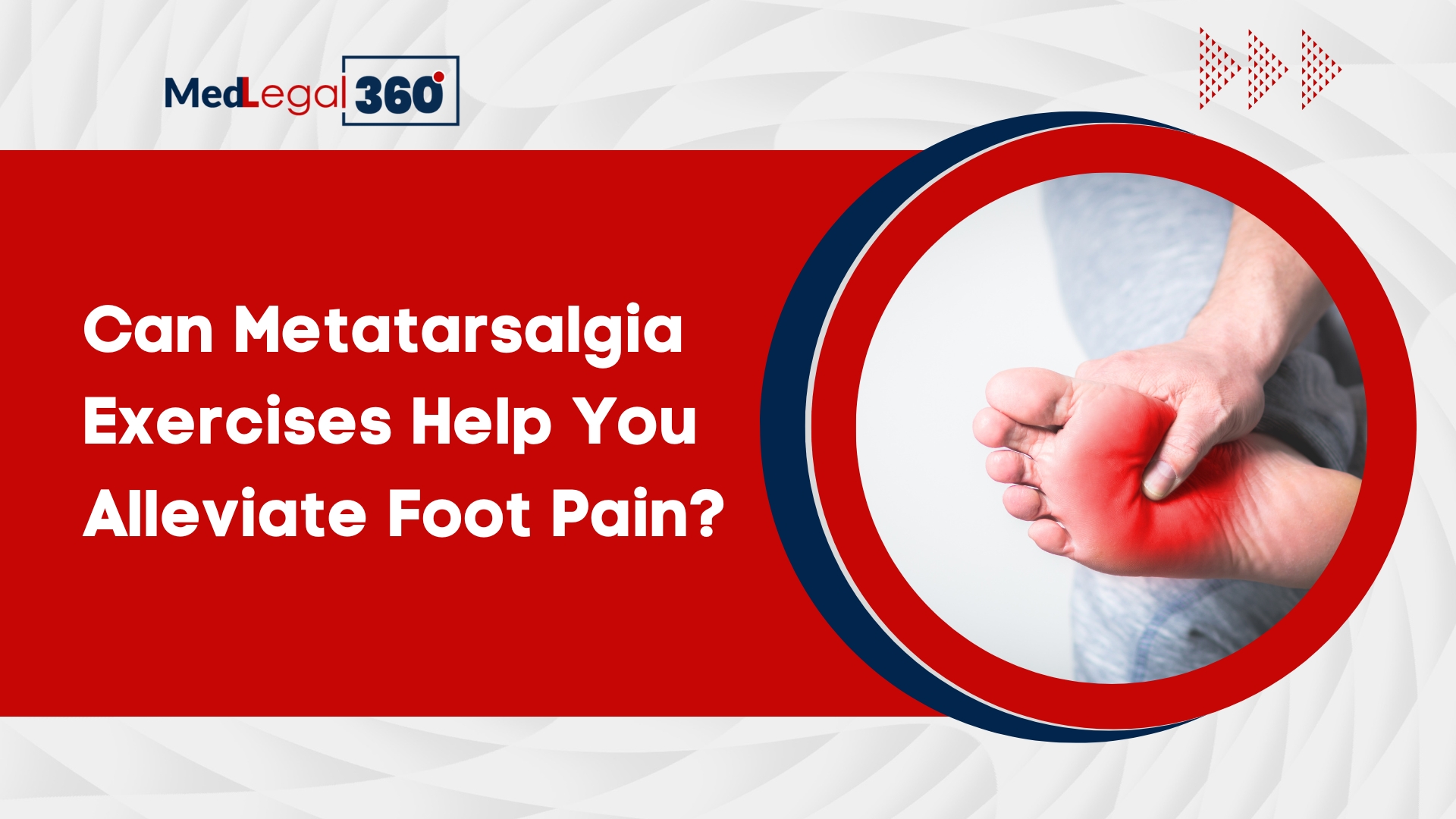 Can Metatarsalgia Exercises Help You Alleviate Foot Pain?