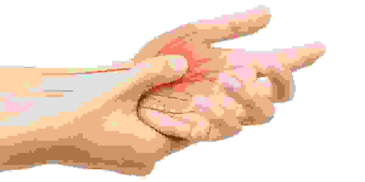 Hand Physio: A Friendly Guide to Strengthening and Rehabilitating Your Hands