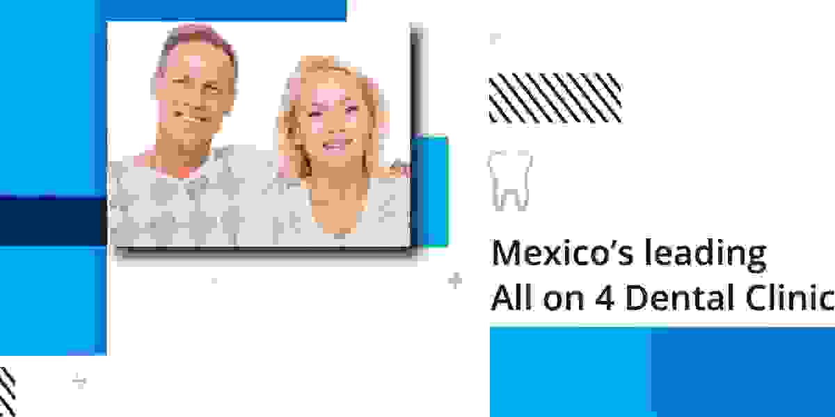 Unveiling the Secrets Behind Mexico Dental Implants' All-on-4 Dental Implant Excellence