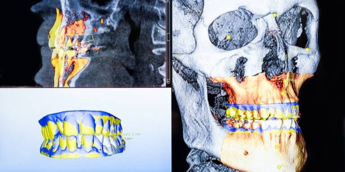 3D Dental Scanner Market Outlook, Trends 2022-2031