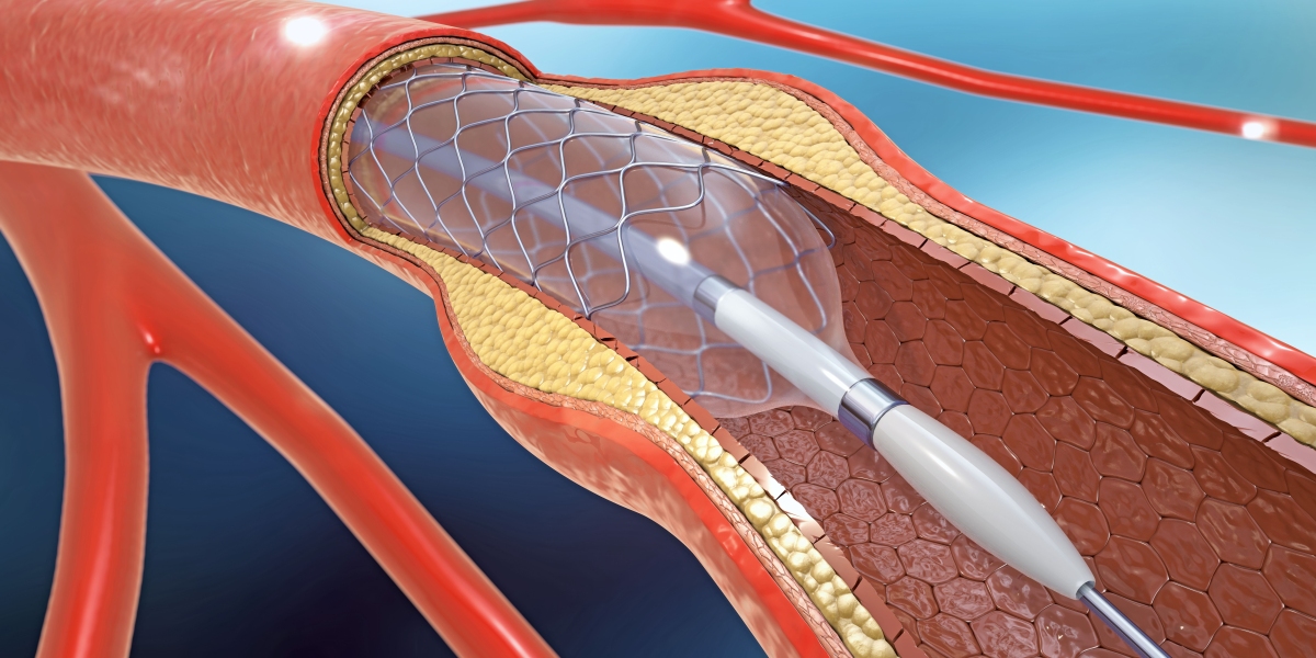 Thrombectomy Devices Market Competitive Landscape Forecast to 2027