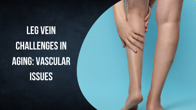 Leg Vein Challenges in Aging: Vascular Issues | theresalamay1234のブログ