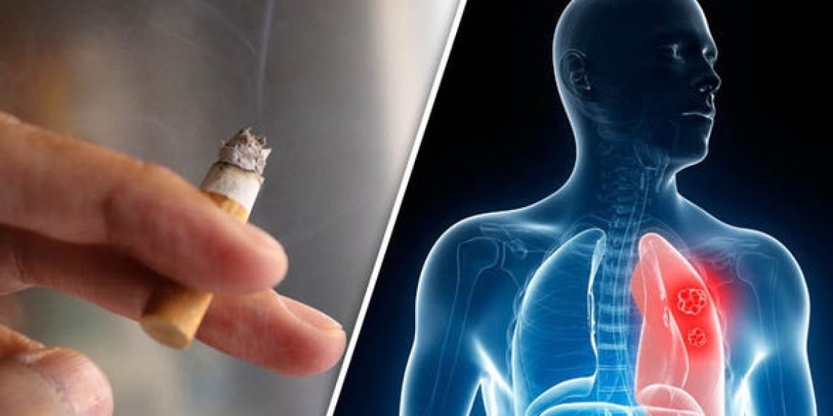 Why Are Lung Cancer Rates Rising In People Who’ve Never Smoked?