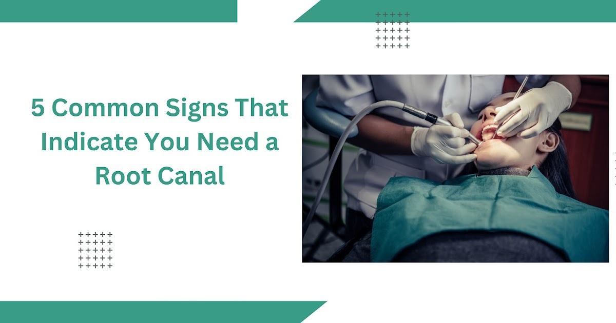 5 Common Signs That Indicate You Need a Root Canal