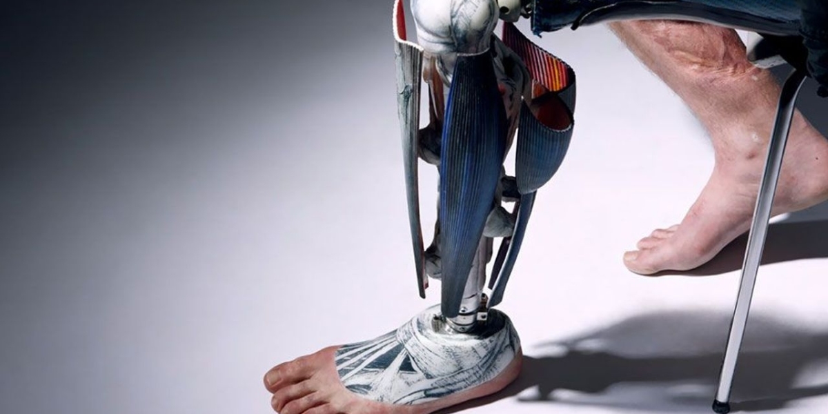 Limb Prosthetics Market Report 2023-2031 : Share, Growth, Size, Trends and Industry Analysis