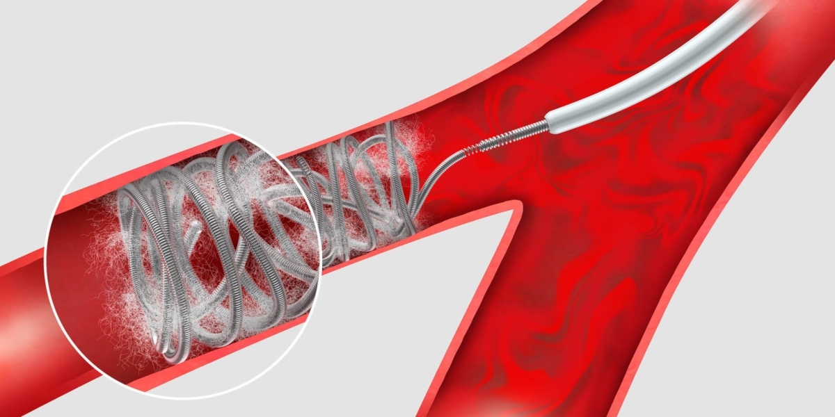 Embolization Agents Market Application Analysis and Growth by Forecast to 2028