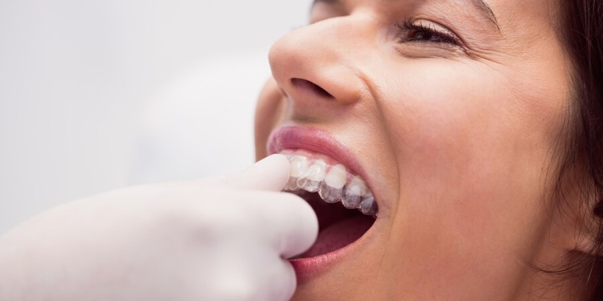 Revolutionizing Smiles: Exploring the Latest Method in Teeth Straightening