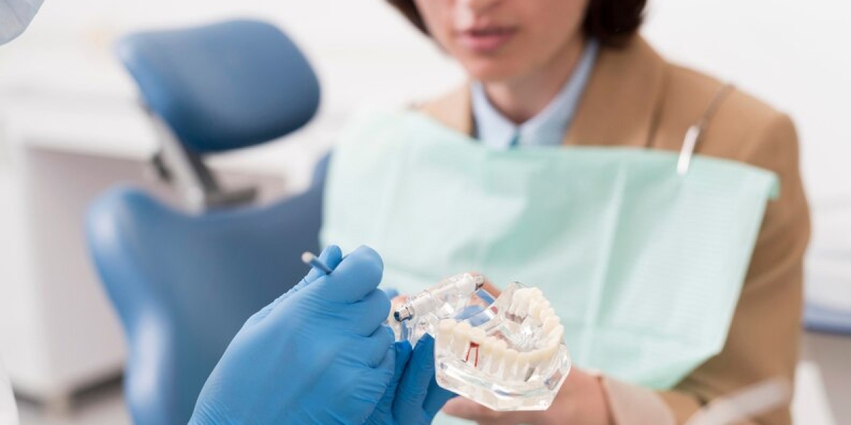 The Versatility of Dental Cement: From Fillings to Crowns