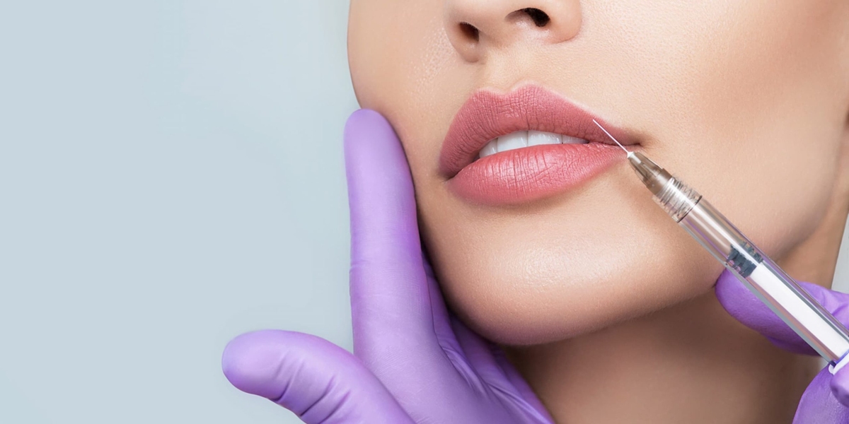 The Top 10 Myths About Lip Fillers