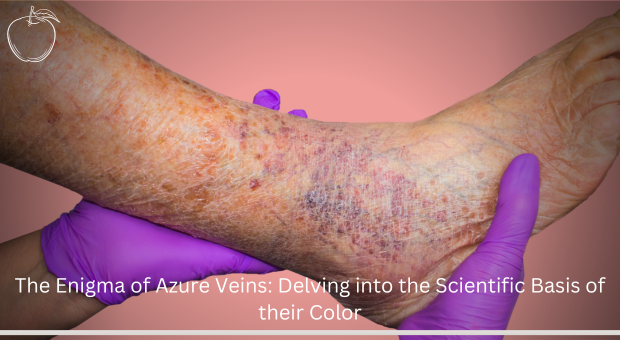 The Enigma of Azure Veins: Delving into the Scientific Basis of their Color – vascular