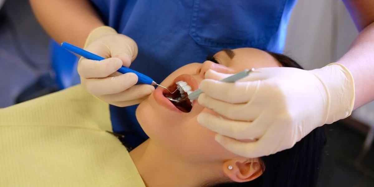 Dental Cement: Finding the Perfect Balance Between Durability, Flexibility, and Beauty