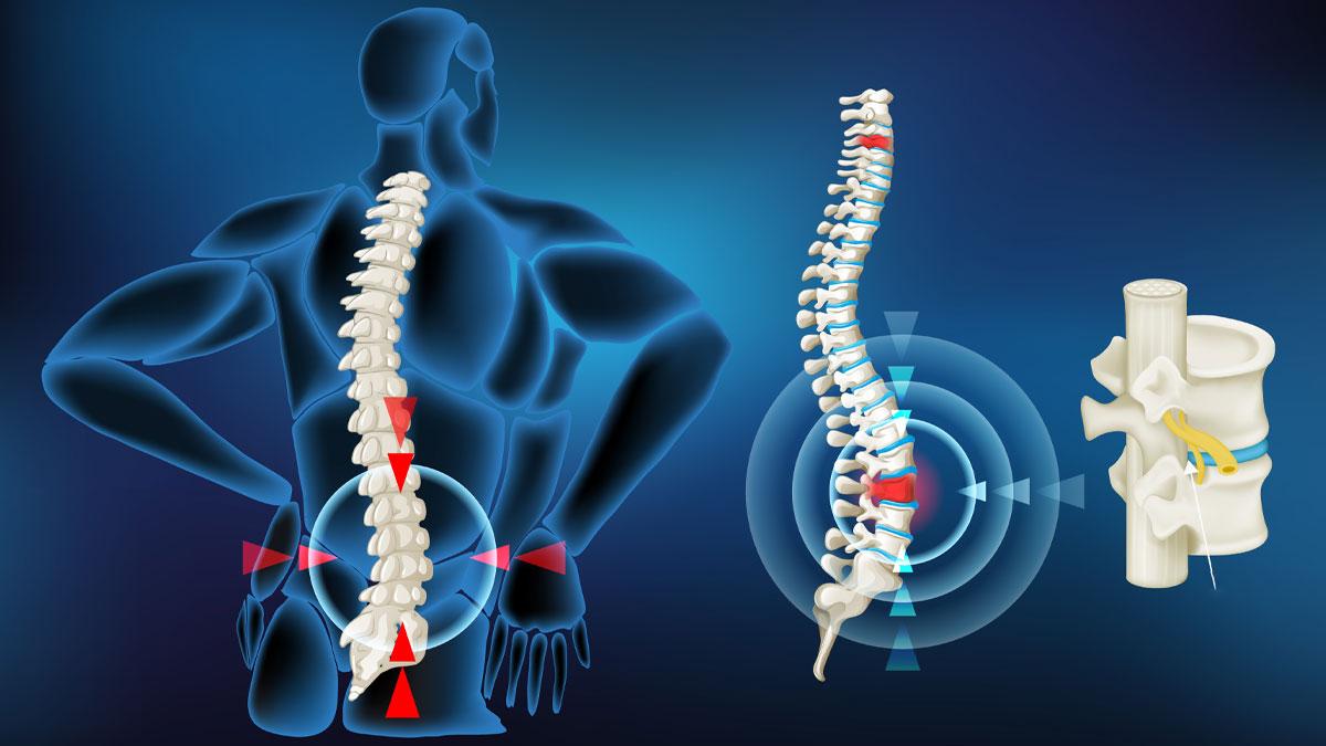 Best Orthopedic Spine Specialist