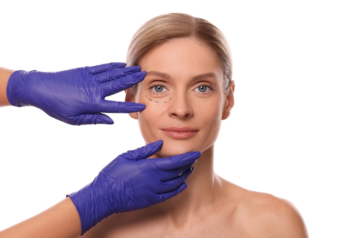 Unveiling the Secrets of Blepharoplasty: A Comprehensive Guide