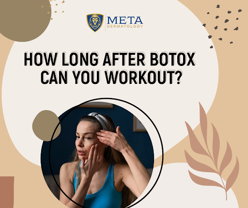 When Can I Start Exercise after Botox?