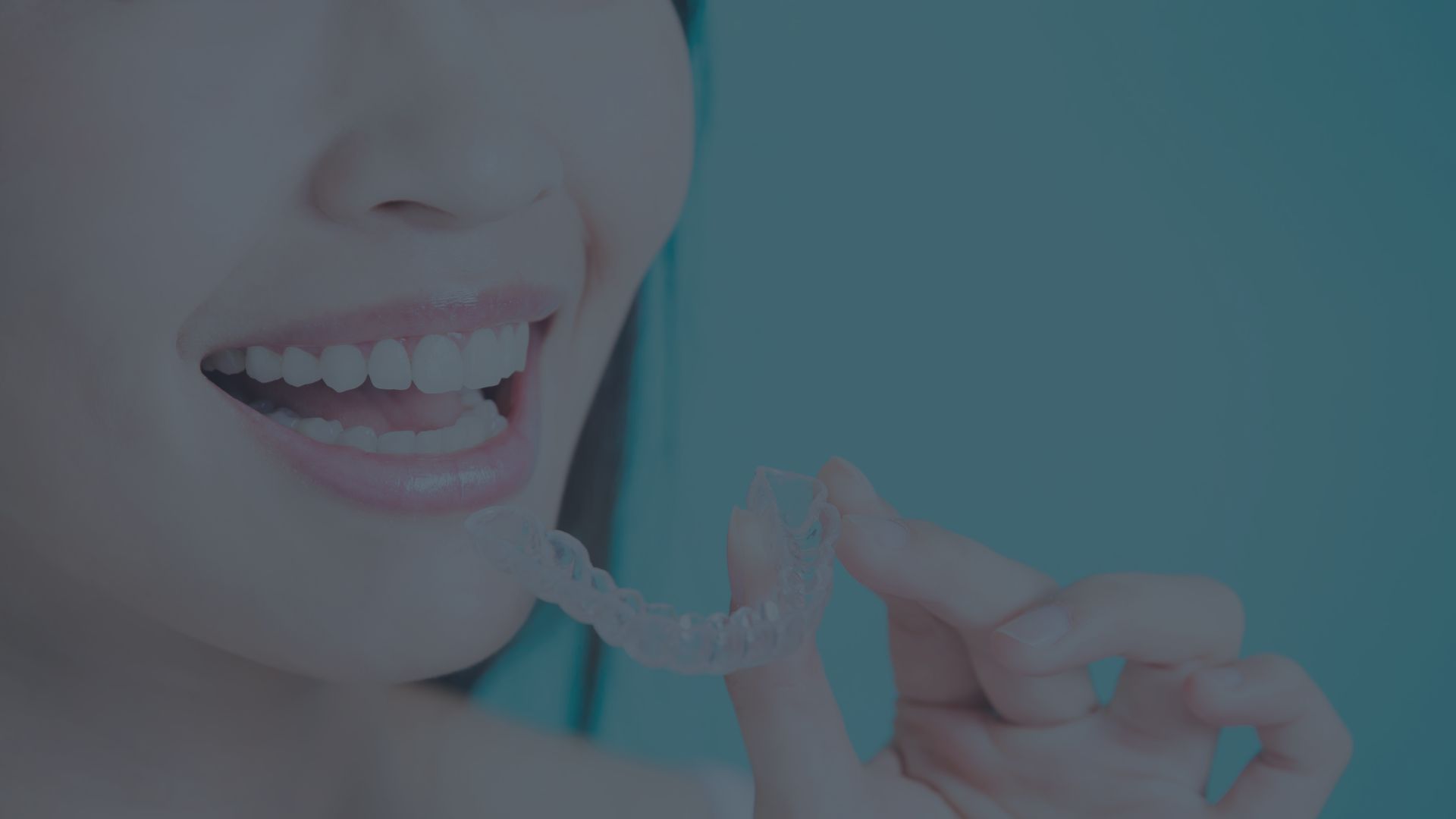 Navigating the Choice Between Invisalign and Traditional Braces » WingsMyPost