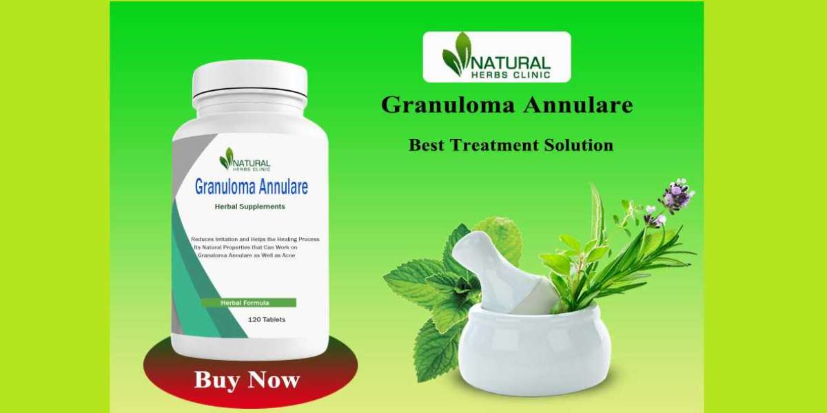 Granuloma Annulare Over the Counter Treatment: Effective Options and Solutions - Natural Herbs Clinic Blog