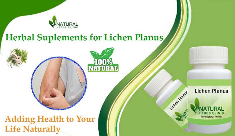 Lichen Planus Natural Alternative Treatment With Herbal Remedies - Natural Herbs Clinic Blog