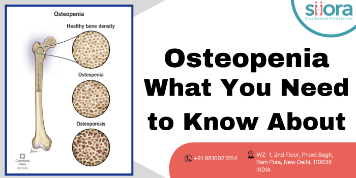 Osteopenia – What You Need to Know About? – Orthopedic Implants Suppliers