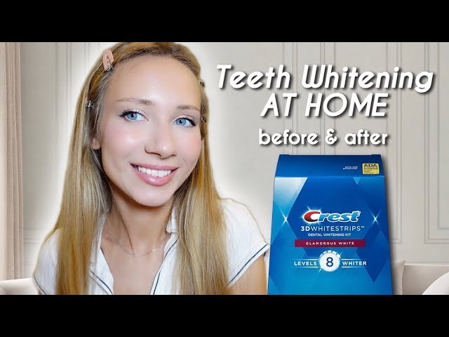 Crest 3D Whitening Strips: The Fastest Way to Whiter Teeth?