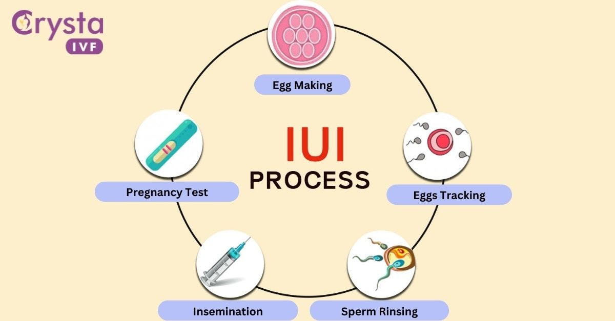 IUI Success Rates: Your Guide to a Successful Pregnancy