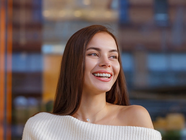 Braces in Allen, TX | Prime DDS Fairview Dental