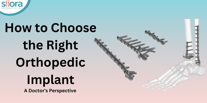 How to Choose the Right Orthopedic Implant: A Doctor’s Perspective – Site Title