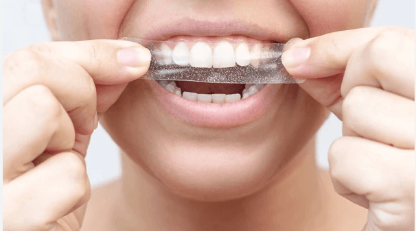 Why Crest Whitening Strips Are the Best Choice for a Whiter Smile