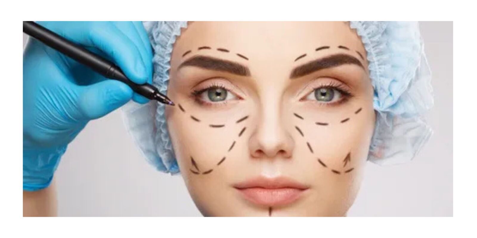 Best Plastic Surgeon in Delhi | Best Cosmetic Surgeon in Delhi - Dr Vivek Kumar