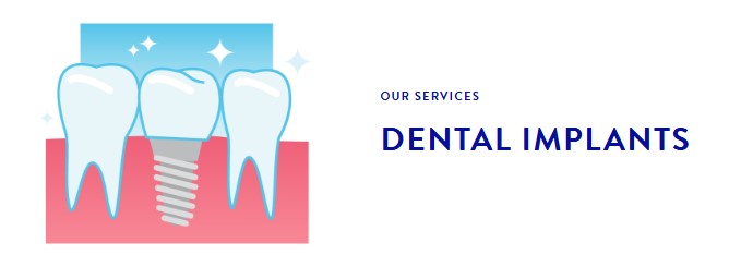 What Makes a Great Implant Dentist in Germantown?