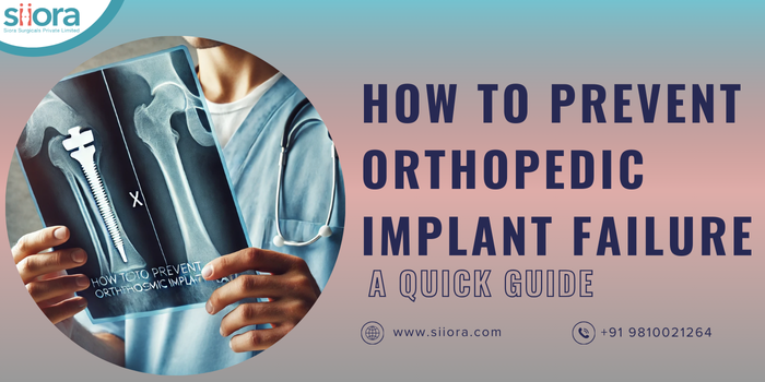 How to Prevent Orthopedic Implant Failure? A Quick Guide. – Orthopedic Implant Company