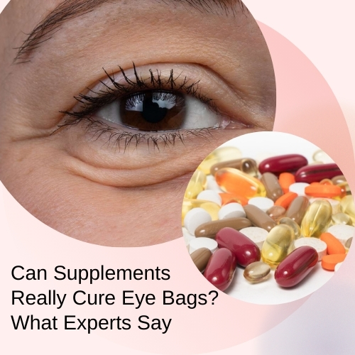 Can Supplements Really Cure Eye Bags? What Experts Say - Natural Herbs Clinic Blog