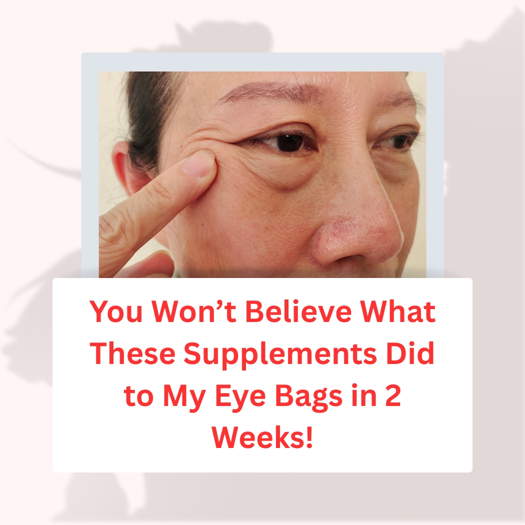 You Won’t Believe What These Supplements Did to My Eye Bags in 2 Weeks! - Herbs Solutions By Nature Blog