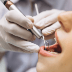7 Signs You Need to See a Dentist Immediately (Don’t Ignore #3)